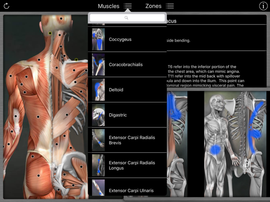 Muscle Trigger Points Ipad images