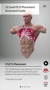 3D ECG Leads screenshot