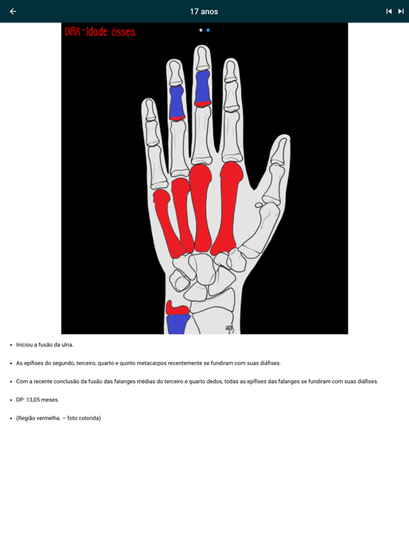 DIAX - Idade Ósseaのおすすめ画像4