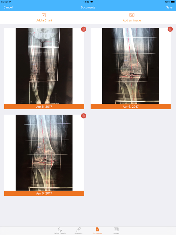 Screenshot #5 pour SURGERi