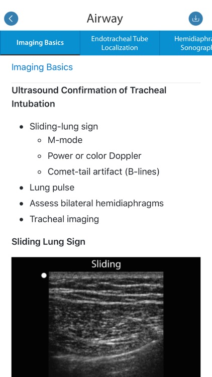 SonoSim screenshot-3