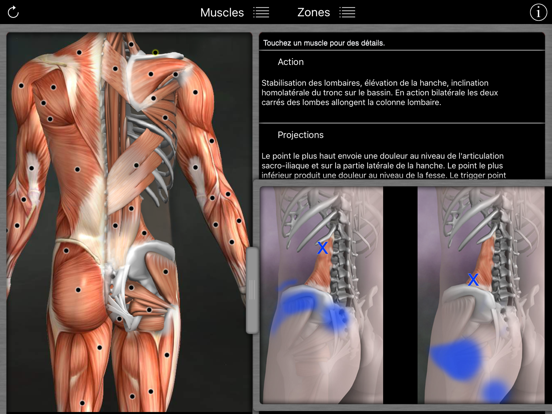 Screenshot #4 pour Muscle Trigger Points