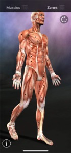 Muscle Trigger Points screenshot #1 for iPhone