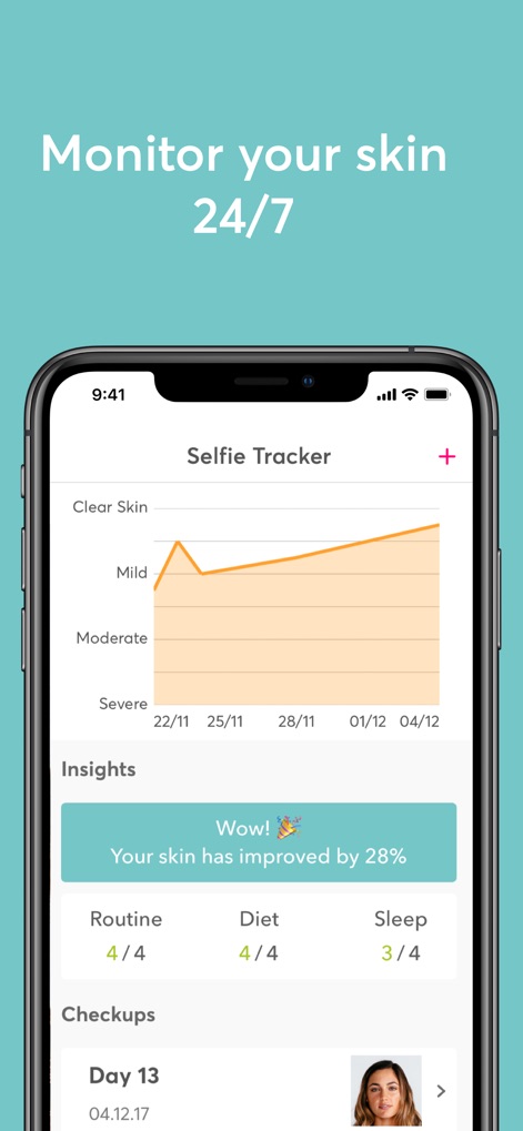 MDacne - Custom Acne Treatment - This feature displays a "Selfie Tracker" graph illustrating skin improvement over time, complemented by "Insights" like a 28% skin enhancement.