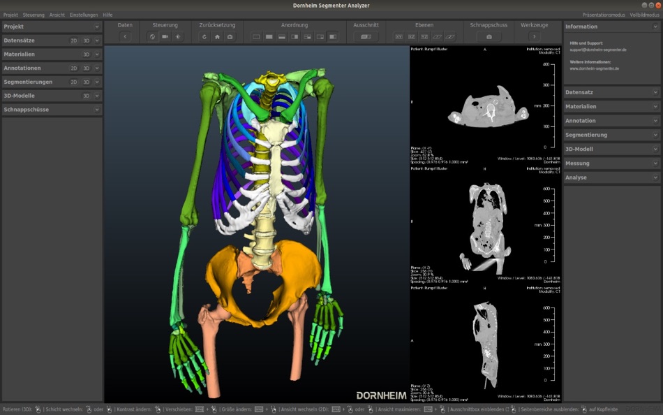 Dornheim DICOM Viewer - 1.5 - (macOS)