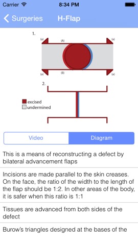 Surgical Flapsのおすすめ画像2