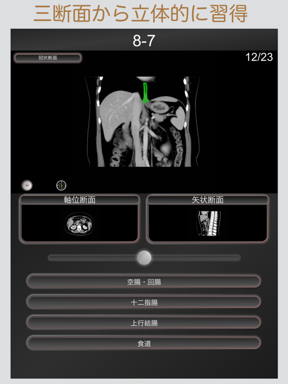 CT PassQuiz 腹部 / 断面図/解剖 /MRIのおすすめ画像3