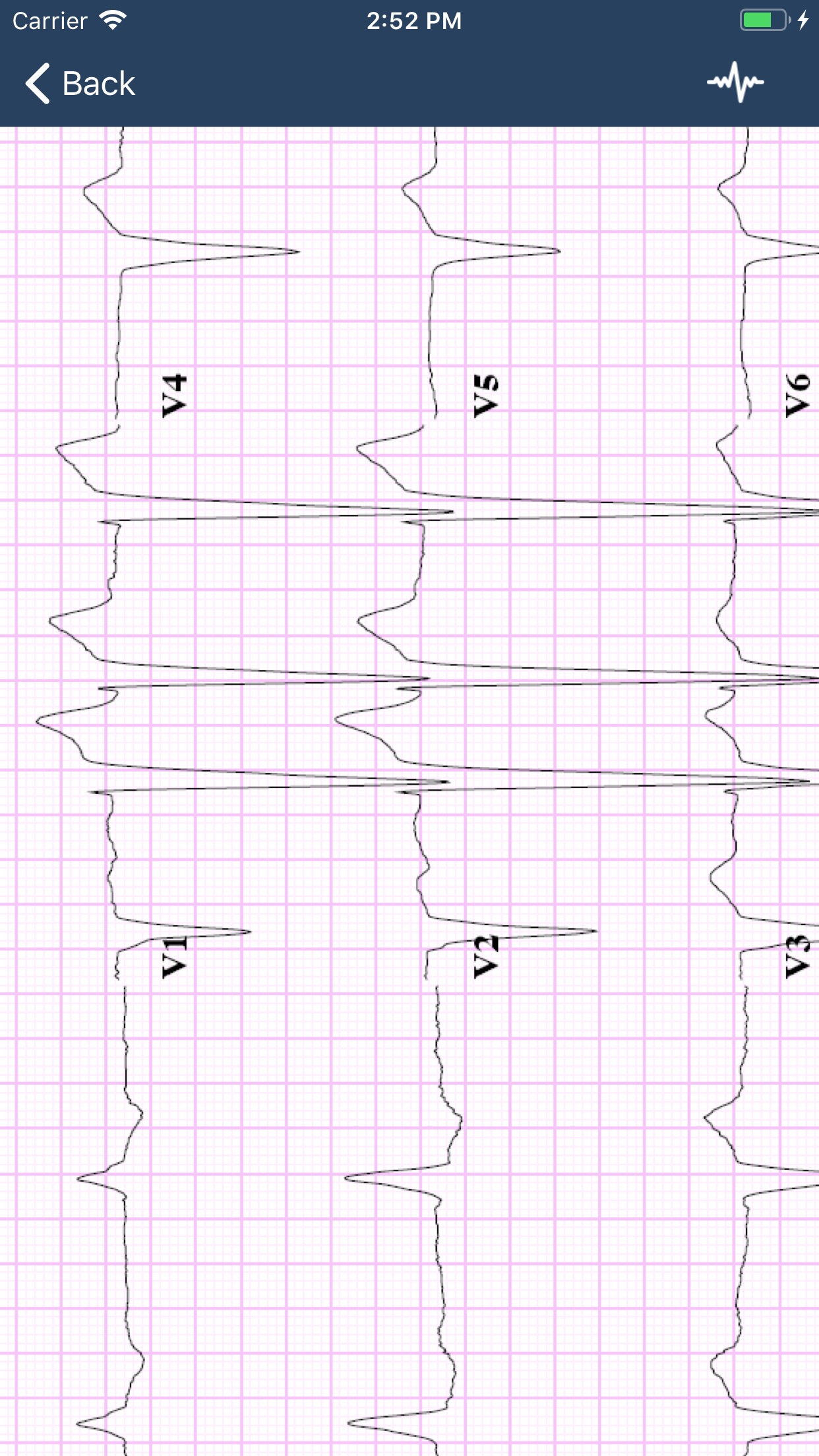 Screenshot 3 of ECG Guide