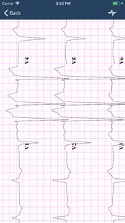 ecg guide iphone screenshot 3