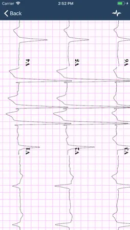 ECG Guide screenshot 3