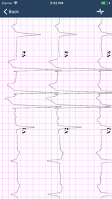 ECG Guide screenshot