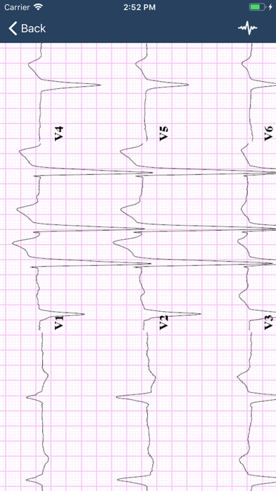 Screenshot #3 pour ECG Guide