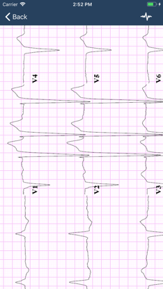 ECG Guide screenshot 3