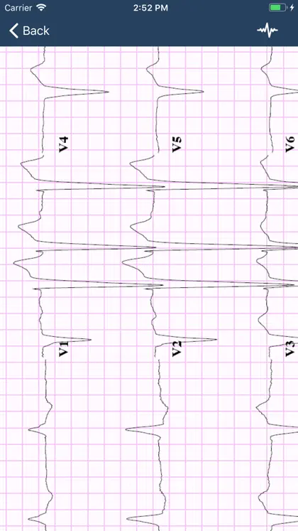Screenshot 3 von 3 zu ECG Guide