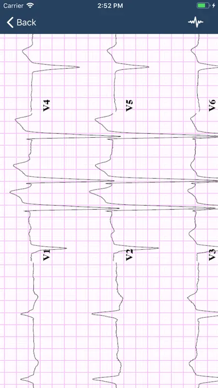 ECG Guide screenshot 3 of 3