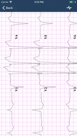 Captura de pantalla de ECG Guide en iPhone 3