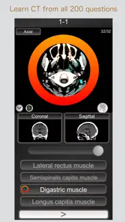 ct passquiz head/brain / mri iphone screenshot 1