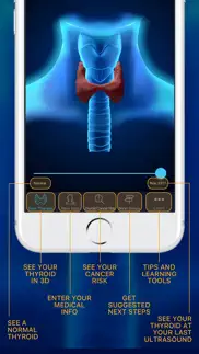 thyroid nodule & cancer guide iphone screenshot 3