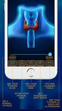 Game screenshot Thyroid Nodule & Cancer Guide hack