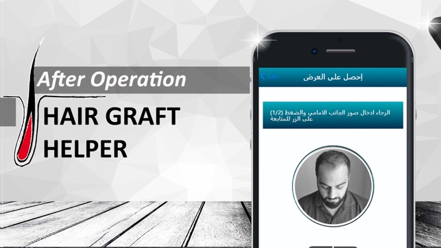 Hair Graft Helper