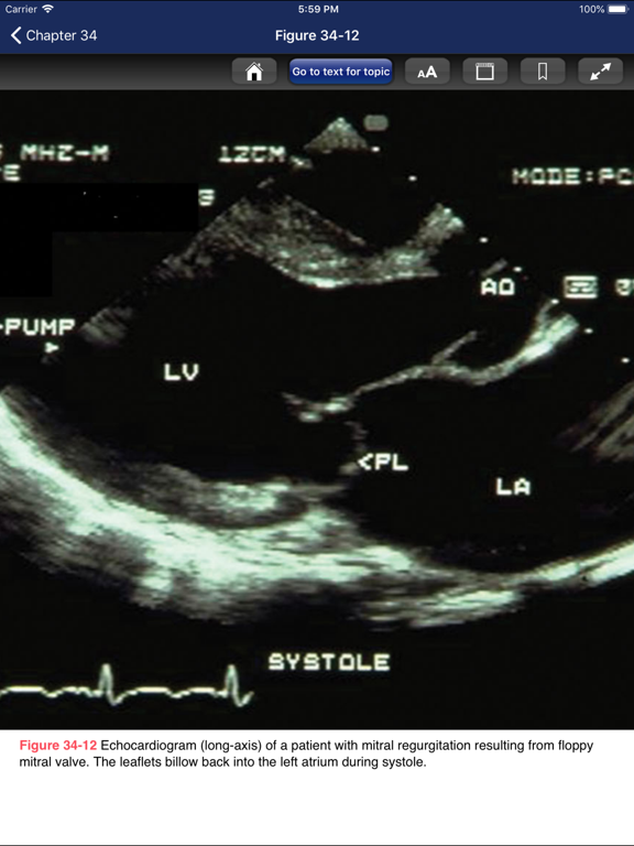 Cardiac Surgery in Adults, 5/E iPad screenshot