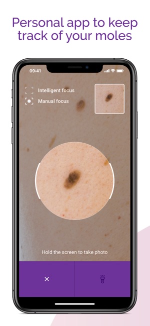 Miiskin - Melanoma Skin Cancer(圖2)-速報App