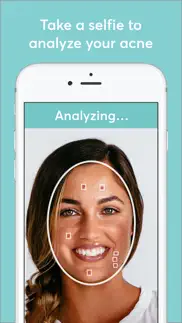 mdacne - custom acne treatment iphone screenshot 1
