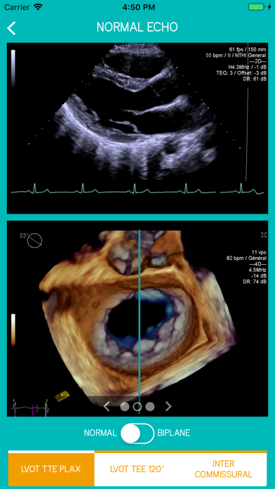 Mitral View Screenshot