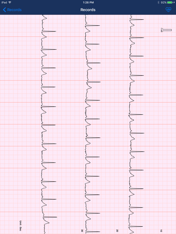 medel iBP ECG iPad screenshot
