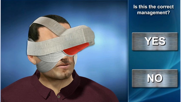 Skull and Brain Injuries