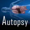 Similar Autopsy Apps