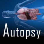 Download Autopsy app