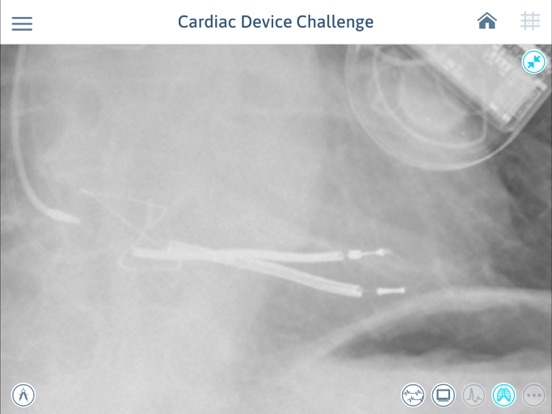 Screenshot #6 pour Cardiac Device Challenge