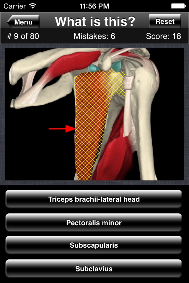 Anatomy Shoulder Quiz screenshot 4