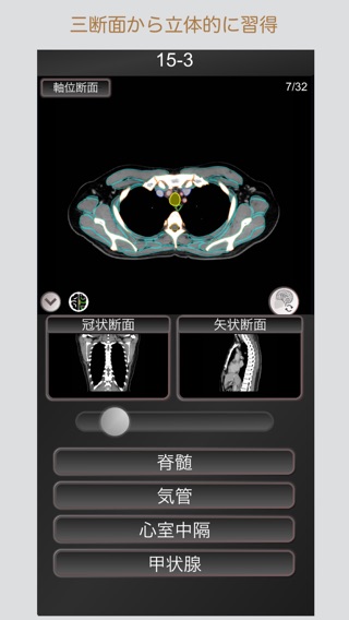 CT PassQuiz コンプリートセット 脳・腹部・胸部のおすすめ画像7