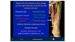 MSK Anatomy - SecondLook iPhone image 4