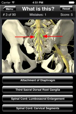 Game screenshot Anatomy Spine Quiz hack