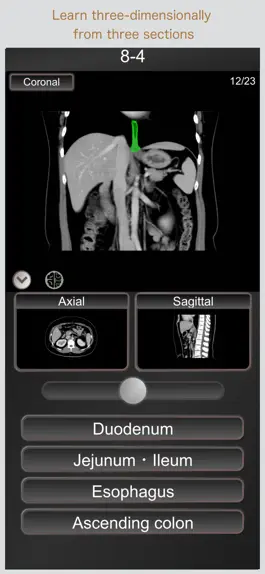Game screenshot CT PassQuiz Abdomen / MRI hack