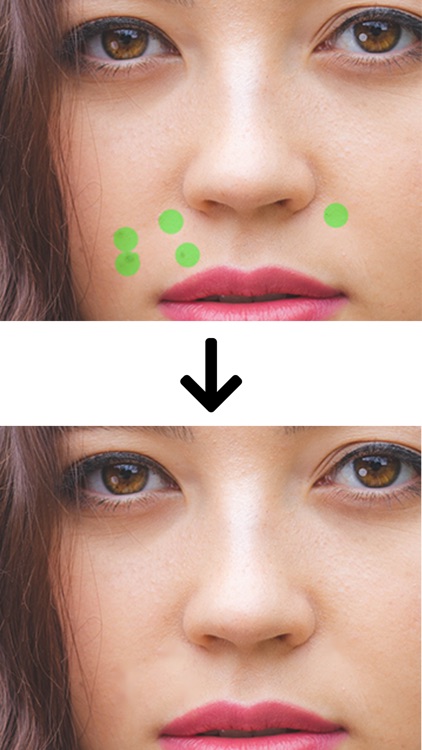 Retouch - Smart Eraser Tool screenshot-6