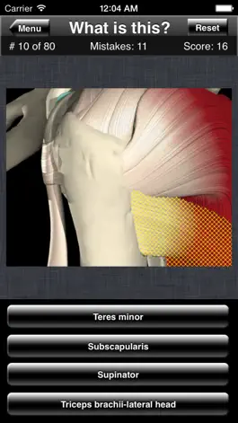Game screenshot Anatomy Shoulder Quiz hack