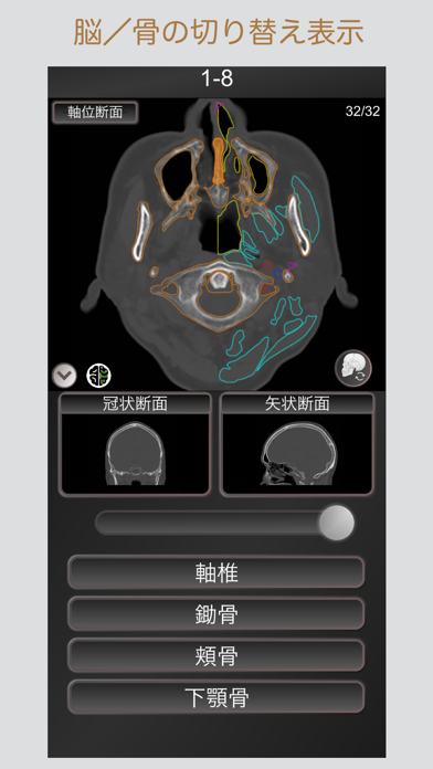 CT PassQuiz 頭部/脳 /CT断... screenshot1