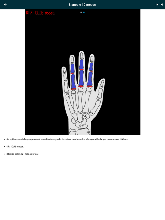 DIAX - Bone Age iPad screenshot 9 - Medical app