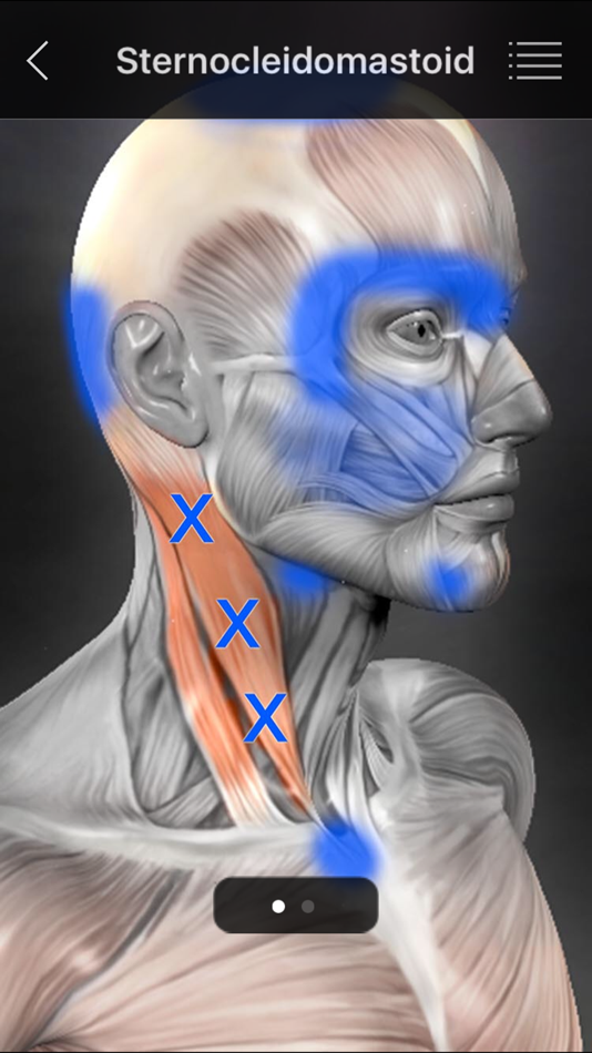 #2. Muscle Trigger Points (iOS) Podle: Real Bodywork