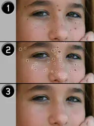 Pimple Eraser LITE ipad bilder 2