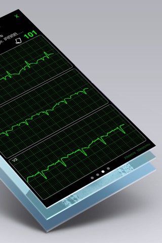 心電図ブック - ECG (EKG) Booksのおすすめ画像1