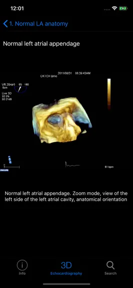 Game screenshot CARDIO3® 3D Echocardiography hack