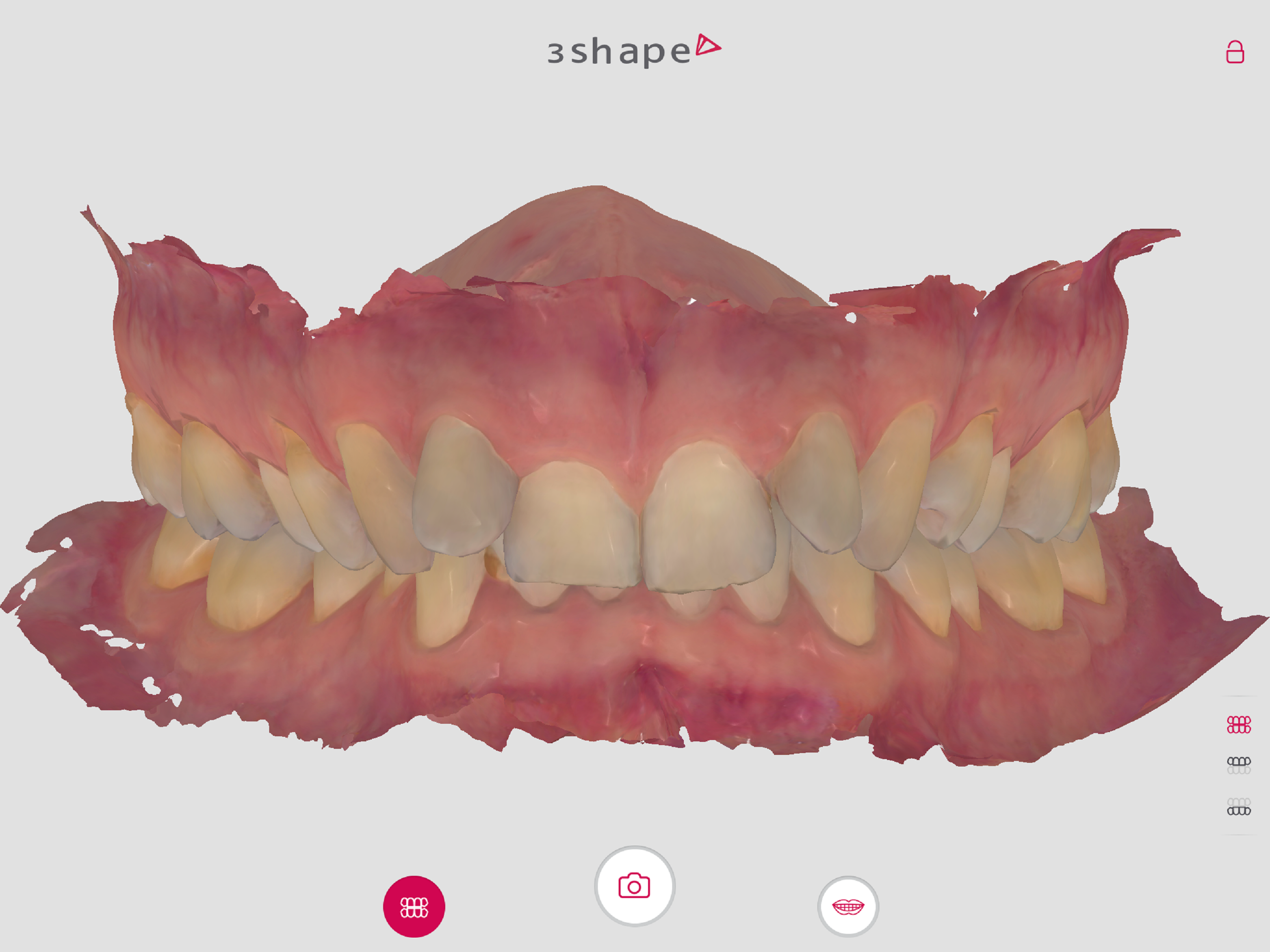 my3Shape for Patients screenshot 6