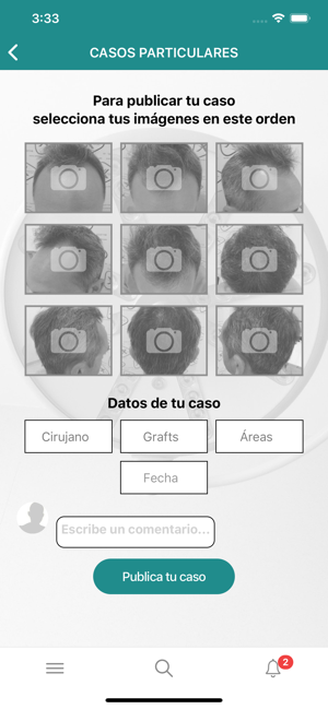 Injerto Capilar(圖5)-速報App