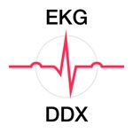 Download EKG DDX app