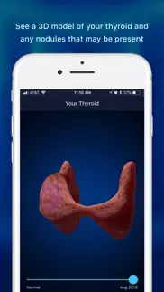 thyroid nodule & cancer guide iphone screenshot 2